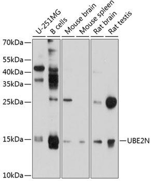 Anti-UBE2N Antibody (CAB10543)