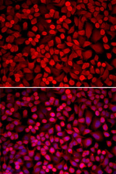 Anti-NCOA1 Antibody (CAB1128)