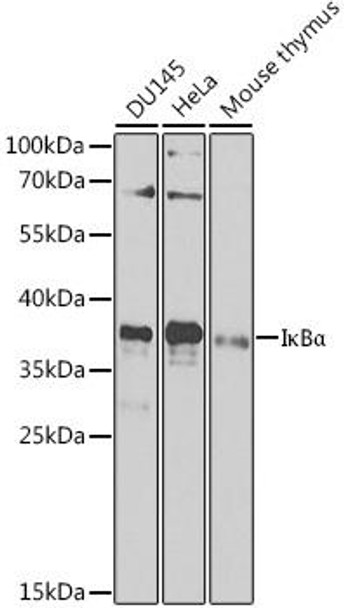 Anti-IkBAlpha Antibody (CAB11474)