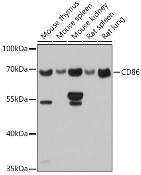 Anti-CD86 Antibody (CAB1199)