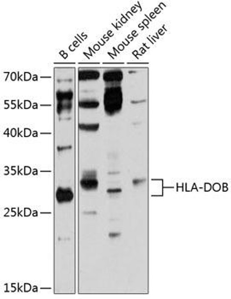 Anti-HLA-DOB Antibody (CAB12152)