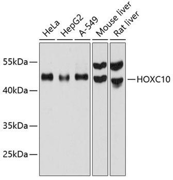 Anti-HOXC10 Antibody (CAB12215)