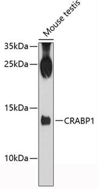Anti-CRABP1 Antibody (CAB12707)