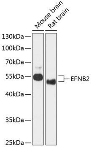 Anti-EFNB2 Antibody (CAB12961)