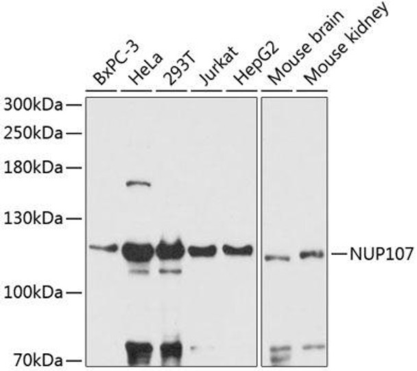 Anti-NUP107 Antibody (CAB13110)