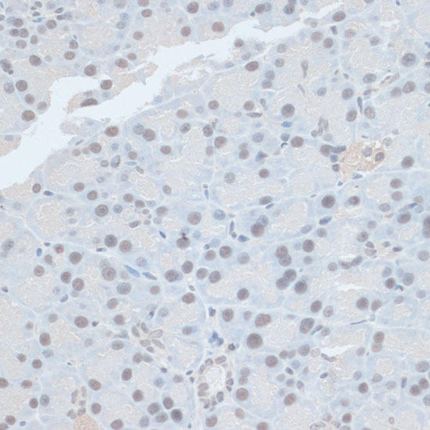 Anti-ZNF581 Antibody (CAB13162)