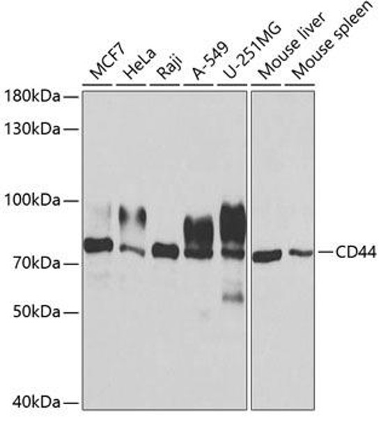 Anti-CD44 Antibody (CAB1351)