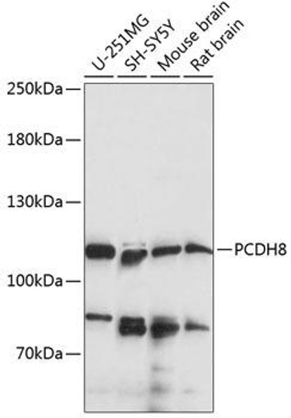 Anti-PCDH8 Antibody (CAB14250)