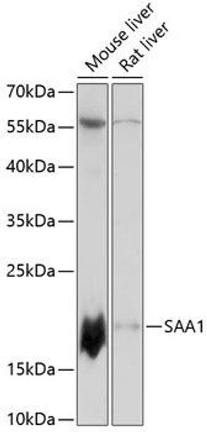 Anti-SAA1 Antibody (CAB14553)