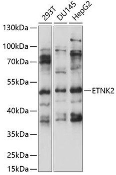 Anti-ETNK2 Antibody (CAB14628)