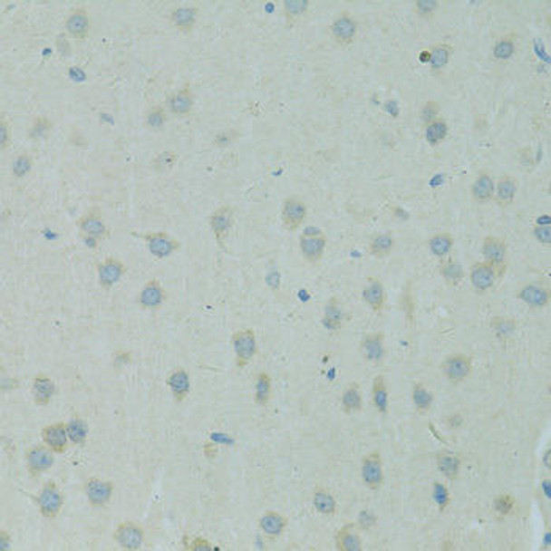 Anti-Smad6 Antibody (CAB14749)