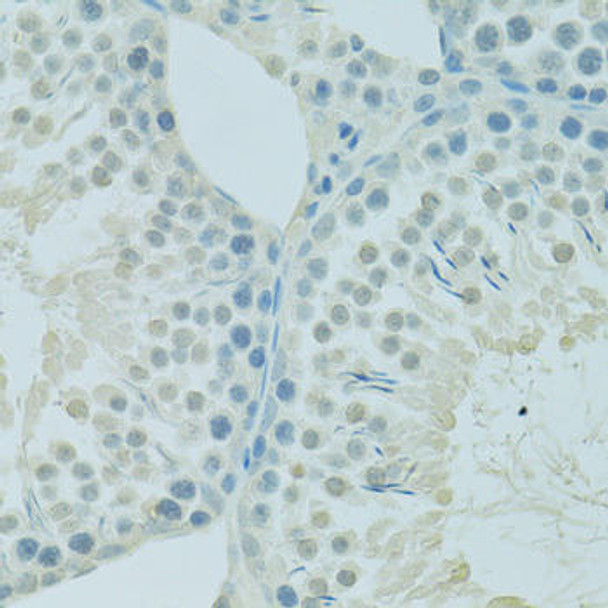 Anti-PSIP1 Antibody (CAB14852)