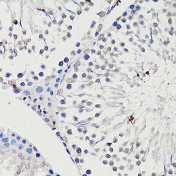 Anti-WT1 Antibody (CAB16319)