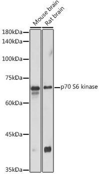 Anti-p70 S6 kinase Antibody (CAB16658)