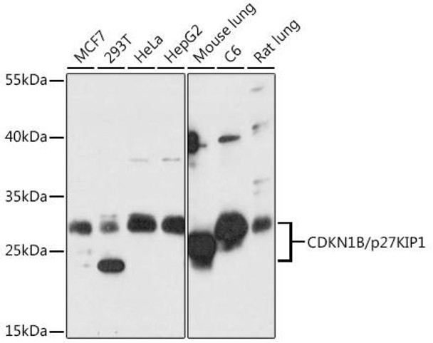 Anti-CDKN1B/p27KIP1 Antibody (CAB16722)