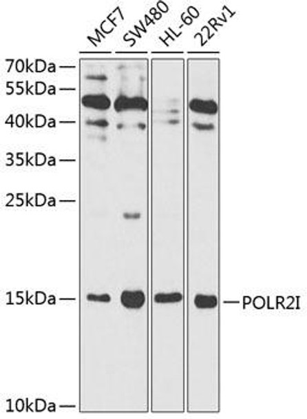 Anti-POLR2I Antibody (CAB1865)