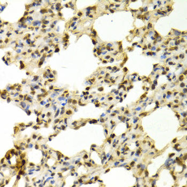 Anti-PADI4 Antibody (CAB1906)