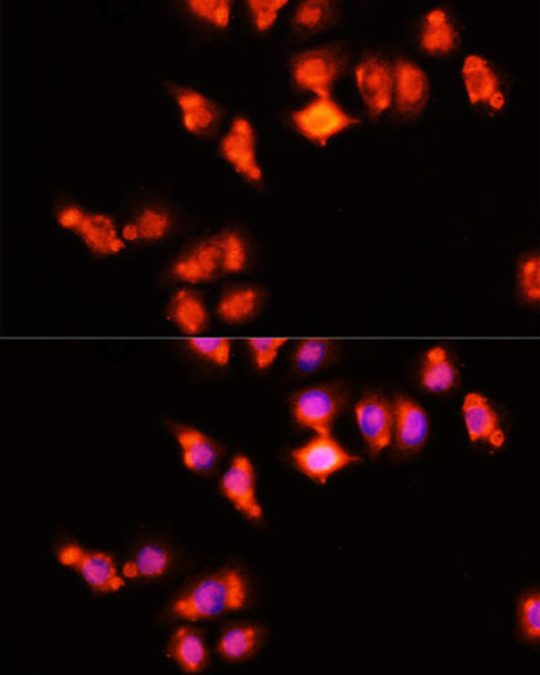 Anti-HOXA11 Antibody (CAB2976)