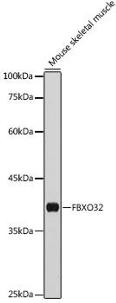 Anti-FBXO32 Antibody (CAB3193)