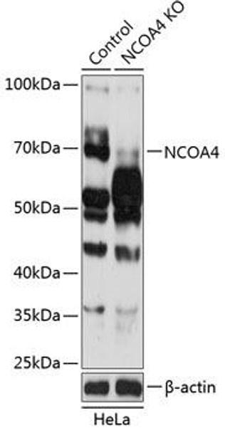 Anti-NCOA4 Antibody (CAB5695)[KO Validated]