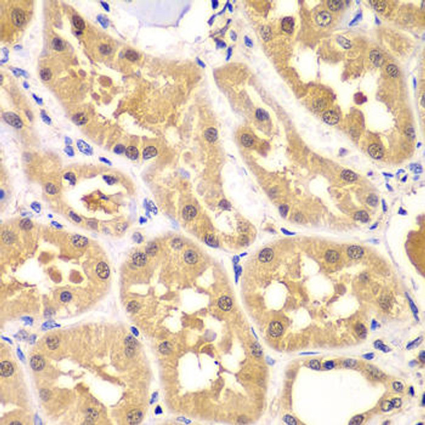 Anti-PRKAG3 Antibody (CAB7470)