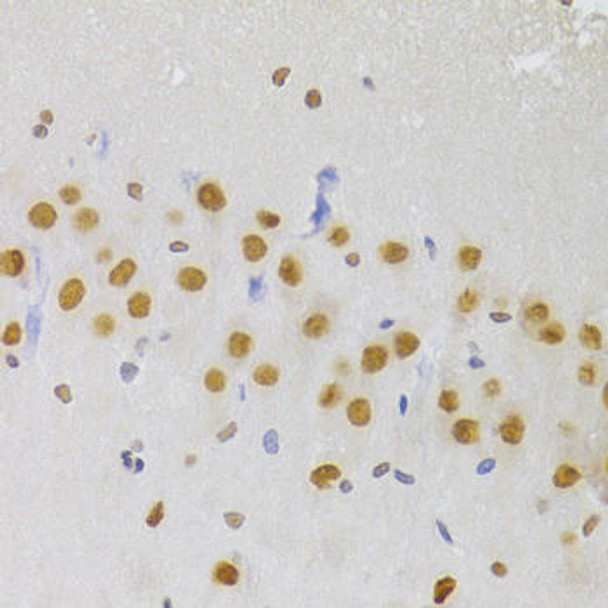 Anti-HNRNPA1 Antibody (CAB7491)