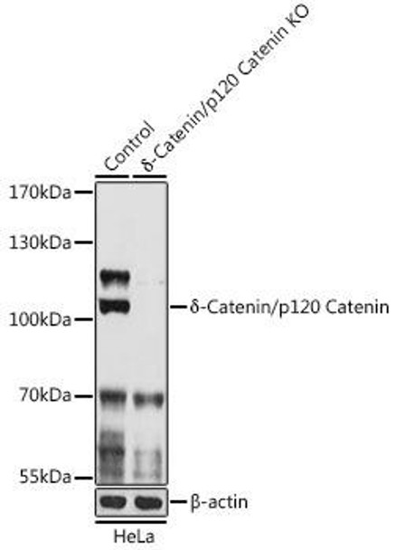 Anti-Delta-Catenin/p120 Catenin Antibody (CAB18043)[KO Validated]