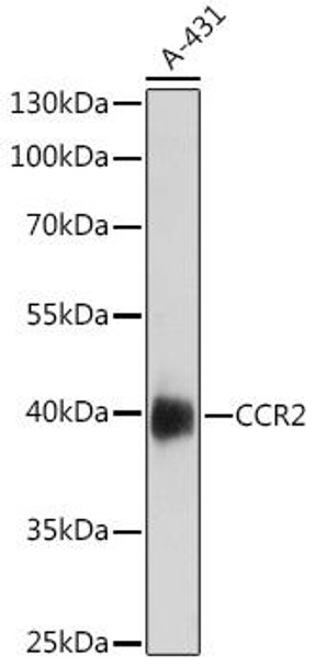 Anti-CCR2 Antibody (CAB18136)
