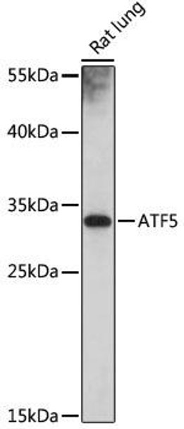 Anti-ATF5 Antibody (CAB18155)