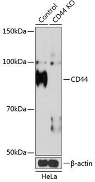 Anti-CD44 Antibody [KO Validated] (CAB19020)