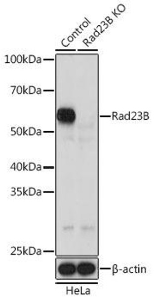 Anti-Rad23B Antibody (CAB20000)[KO Validated]