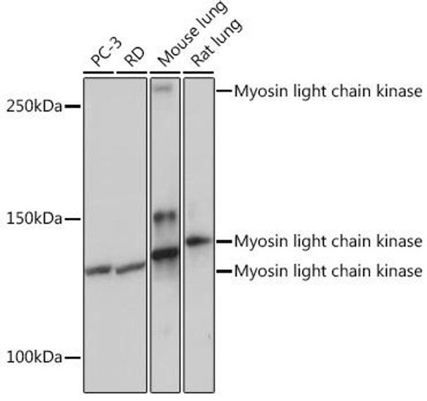 Anti-Myosin light chain kinase Antibody (CAB3835)