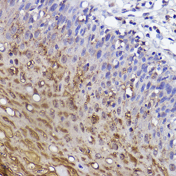 Anti-SerpinB3 Antibody (CAB0455)