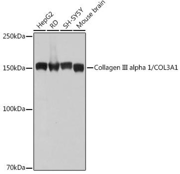 Anti-Collagen III alpha 1/COL3A1 Antibody (CAB0817)