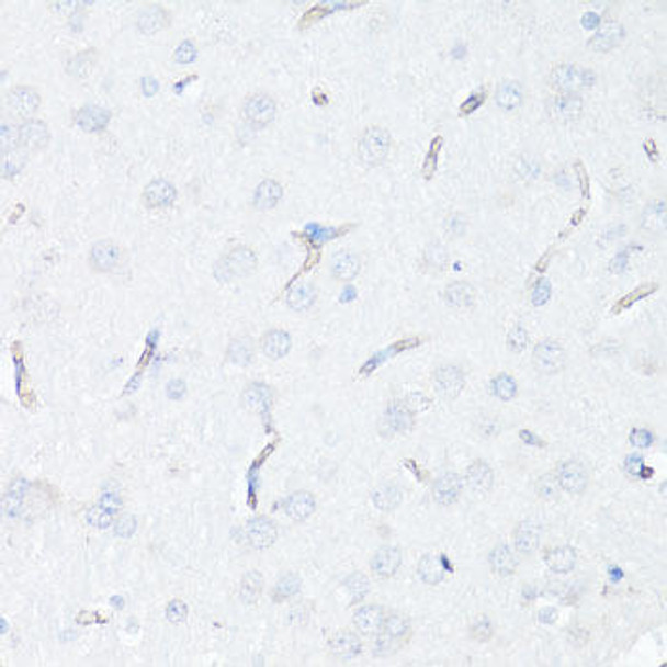 Anti-P Glycoprotein Antibody (CAB11758)