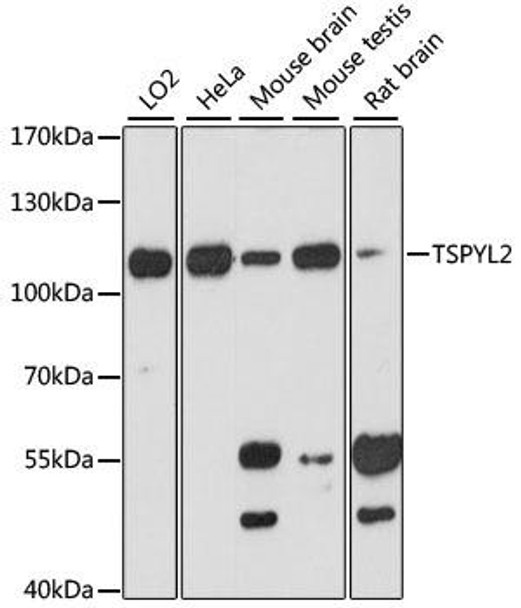 Anti-TSPYL2 Antibody (CAB13118)