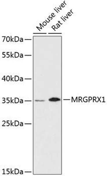 Anti-MRGPRX1 Antibody (CAB13142)