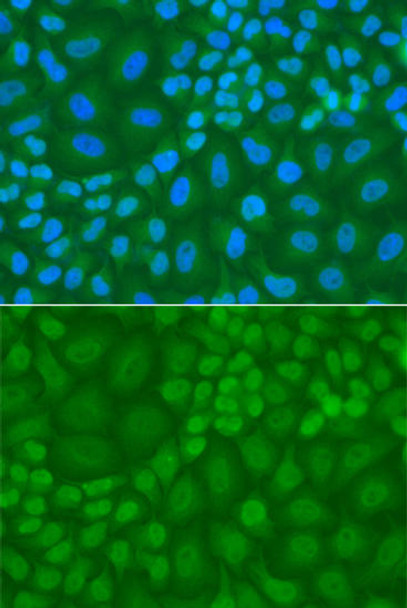 Anti-TDG Antibody (CAB13365)