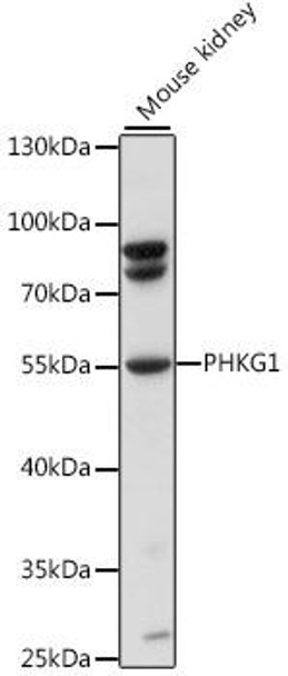 Anti-PHKG1 Antibody (CAB15701)