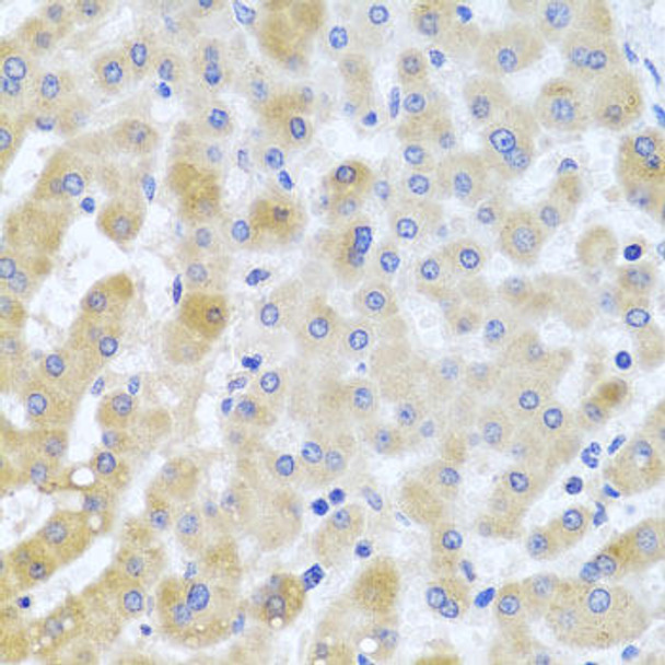 Anti-EIF3M Antibody (CAB4426)