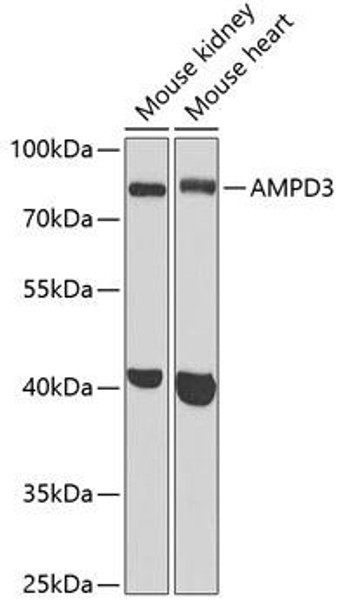 Anti-AMPD3 Antibody (CAB6354)