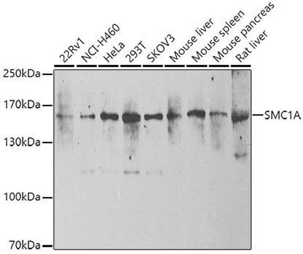 Anti-SMC1A Antibody (CAB7008)