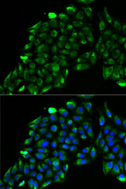 Anti-ACADS Antibody (CAB7230)