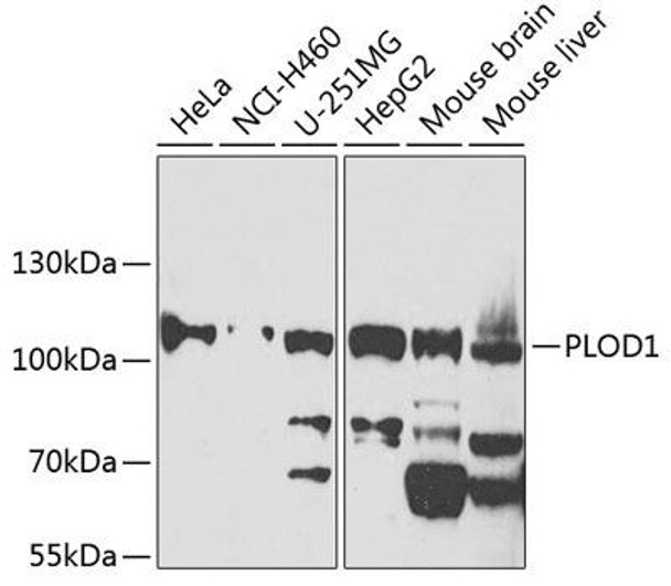 Anti-PLOD1 Antibody (CAB7919)