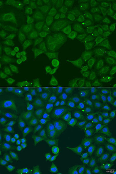 Anti-IFNA4 Antibody (CAB8124)