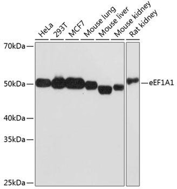 Anti-eEF1A1 Antibody (CAB11545)