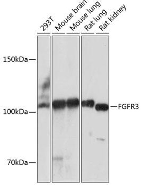 Anti-FGFR3 Antibody (CAB19052)