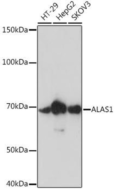 Anti-ALAS1 Antibody (CAB4817)