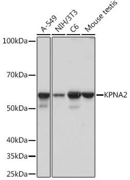 Anti-KPNA2 Antibody (CAB5012)