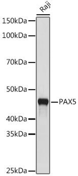 Anti-PAX5 Antibody (CAB9607)